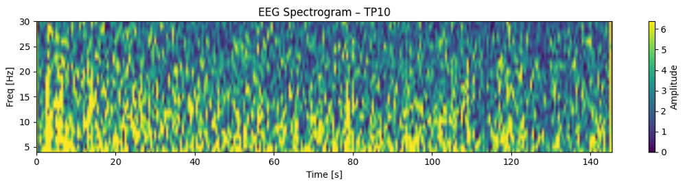 実験2-1：100マス計算中のEEGスペクトログラム